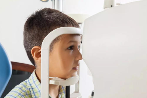 梦戴维角膜塑形镜年龄小度数高案例